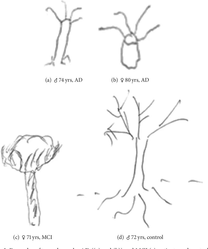contoh gambar tes pohon gangguan kognitif.webp